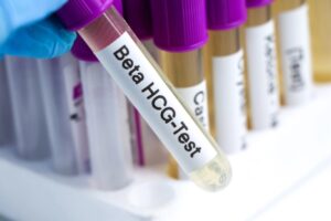 HCG Levels Explained: Assessing Your Miscarriage Risk