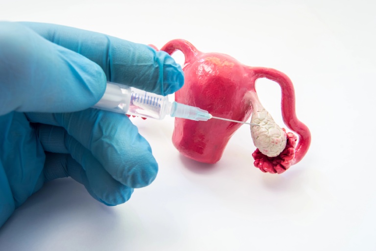 Why Immature Eggs Occur During Ovarian Puncture: A Quick Guide