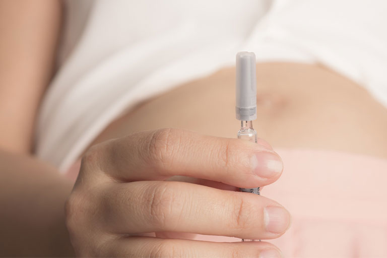 IVF Vs. IUI - Pros And Cons Of Each Fertility Treatment
